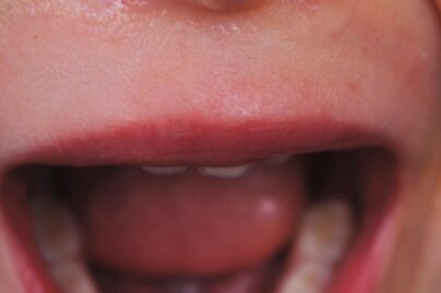 lähikuva itkevästä lapsesta