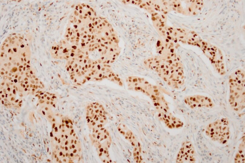 Solukuva nrf2, jossa immunohistokemiallinen värjäys.