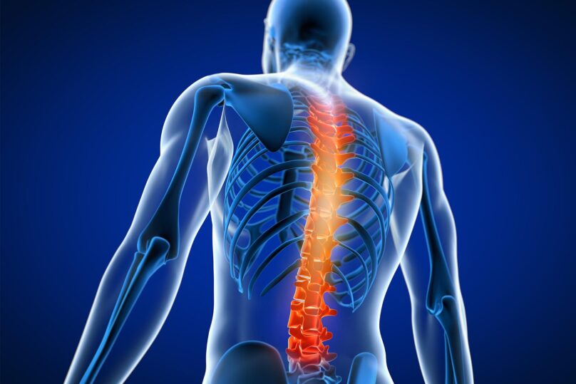 piirretty mieshahmo jolla selkaranka sateilee kipua oranssina muuten sinisessa kuvassa