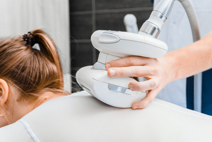 Poninhäntäinen naisasiakas on mahallaan vaaleassa trikoopaidassa, kun hänen selällään on LPG-laite tekemässä hoitoa.