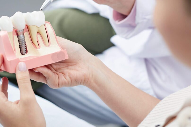 Naishammaslääkäri katselee hammasproteesin mallia