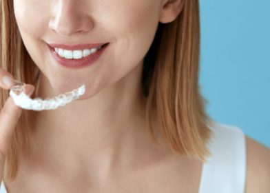 naisella kadessa invisalign hammasraudat