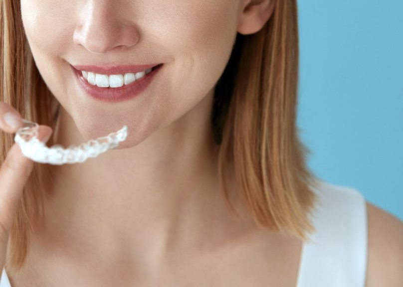 naisella kadessa invisalign hammasraudat