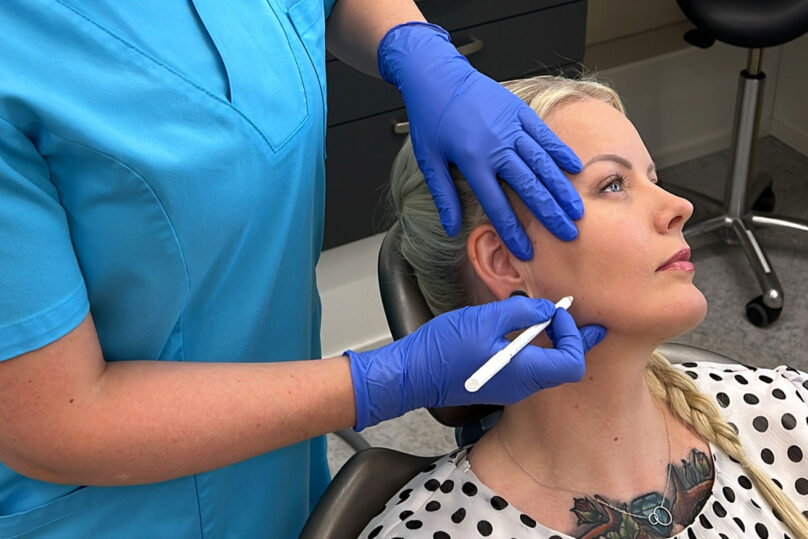 Hammaslääkäri merkitsee kynällä asiakkaan kasvoihin botuliinin pistoskohdat.