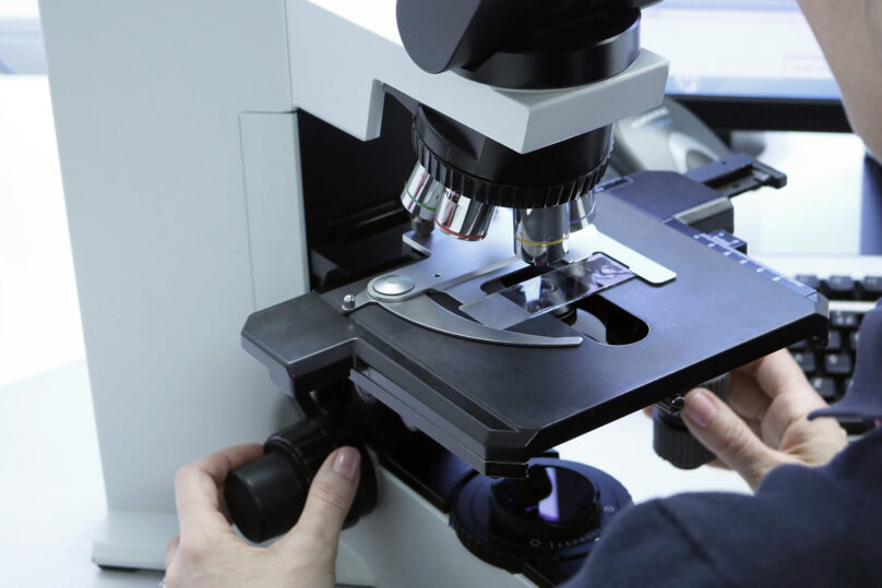 Coronaria Diagnostiikka tuottaa laadukkaita patologian alan palveluita asiakkaille yksityisessä ja julkisessa terveydenhuollossa. Kuvassa patologi tutkii näytettä mikroskoopilla.