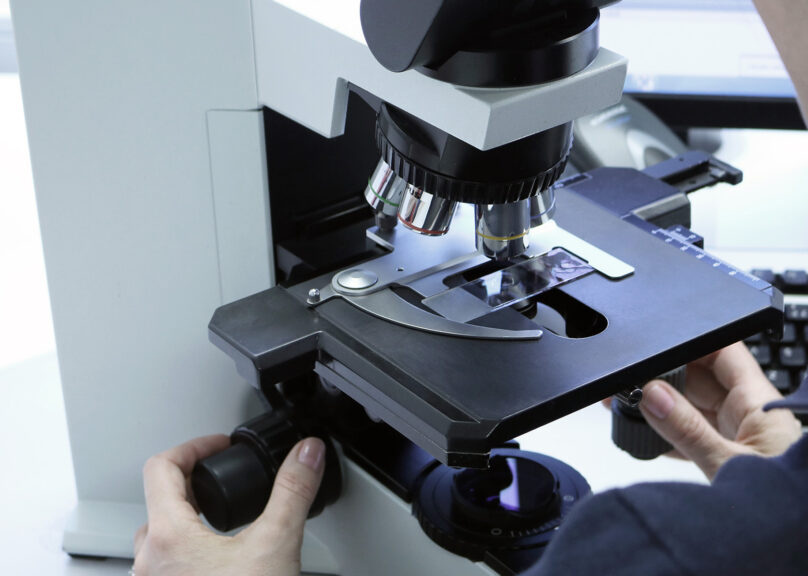Coronaria Diagnostiikka tuottaa laadukkaita patologian alan palveluita asiakkaille yksityisessä ja julkisessa terveydenhuollossa. Kuvassa patologi tutkii näytettä mikroskoopilla.