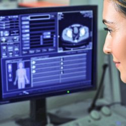 Naislääkäri katsoo ruudulta CT scan tuloksia.