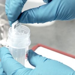 Coronaria diagnostiikan välineistöä lähikuvassa.