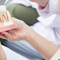 Naishammaslääkäri katselee hammasproteesin mallia